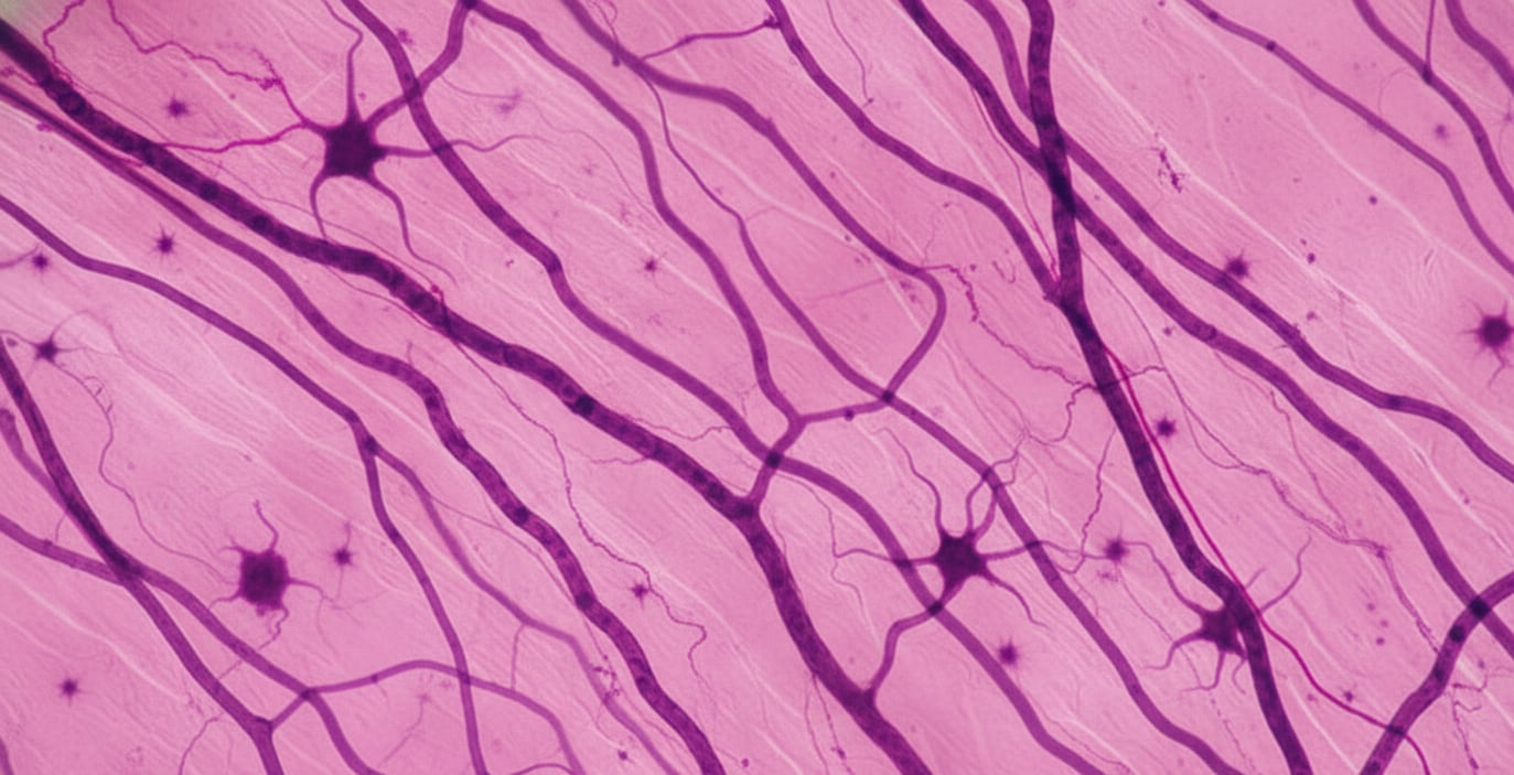 La atención a los tejidos conectivos transforma la prevención de lesiones y eleva el estándar de preparación física en atletas de élite (Imagen Ilustrativa Infobae)
