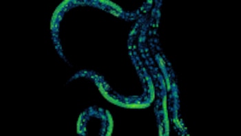 Una hormona vegetal permite controlar