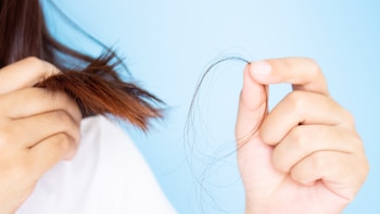 Qué es la tricotilomanía, el