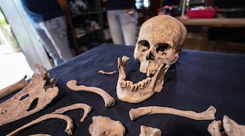 Un cráneo humano, una mandíbula y fragmentos de huesos sobre una superficie oscura con dos personas al fondo.