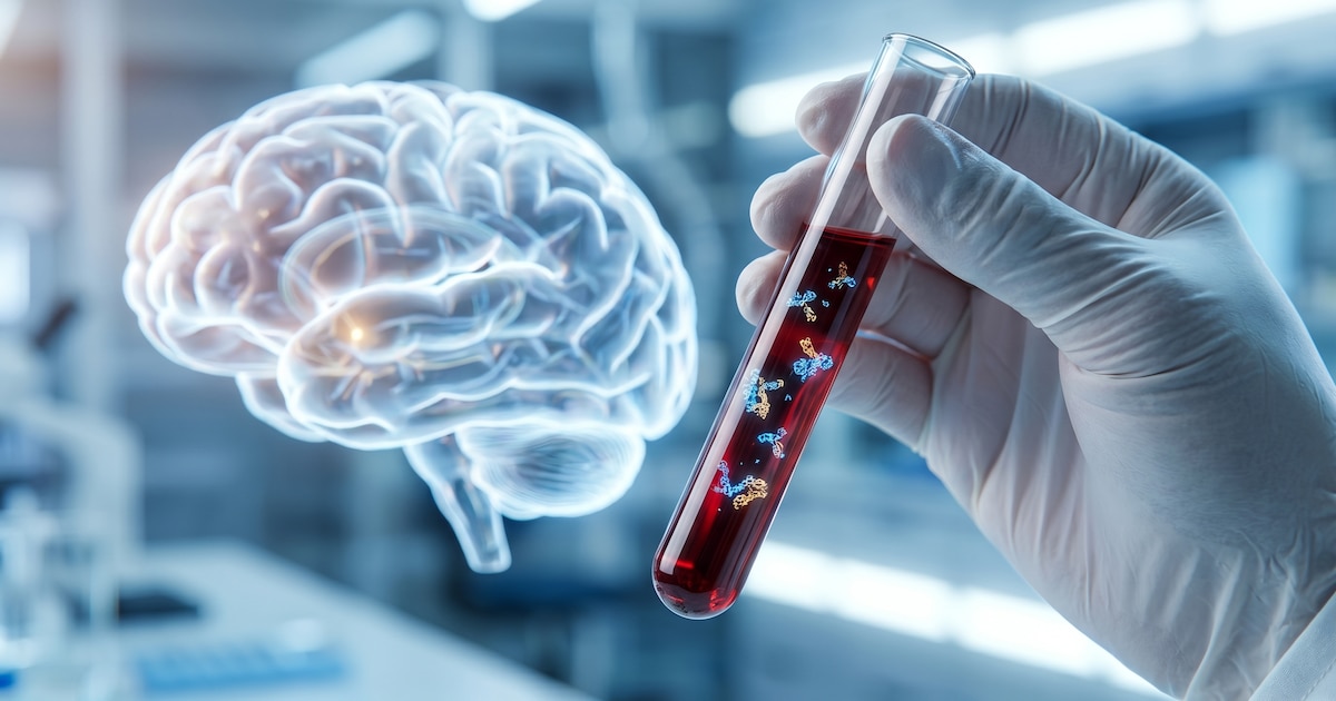 Análisis de sangre: la clave para anticipar el deterioro cognitivo