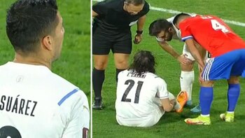 Edinson Cavani suffered a calf