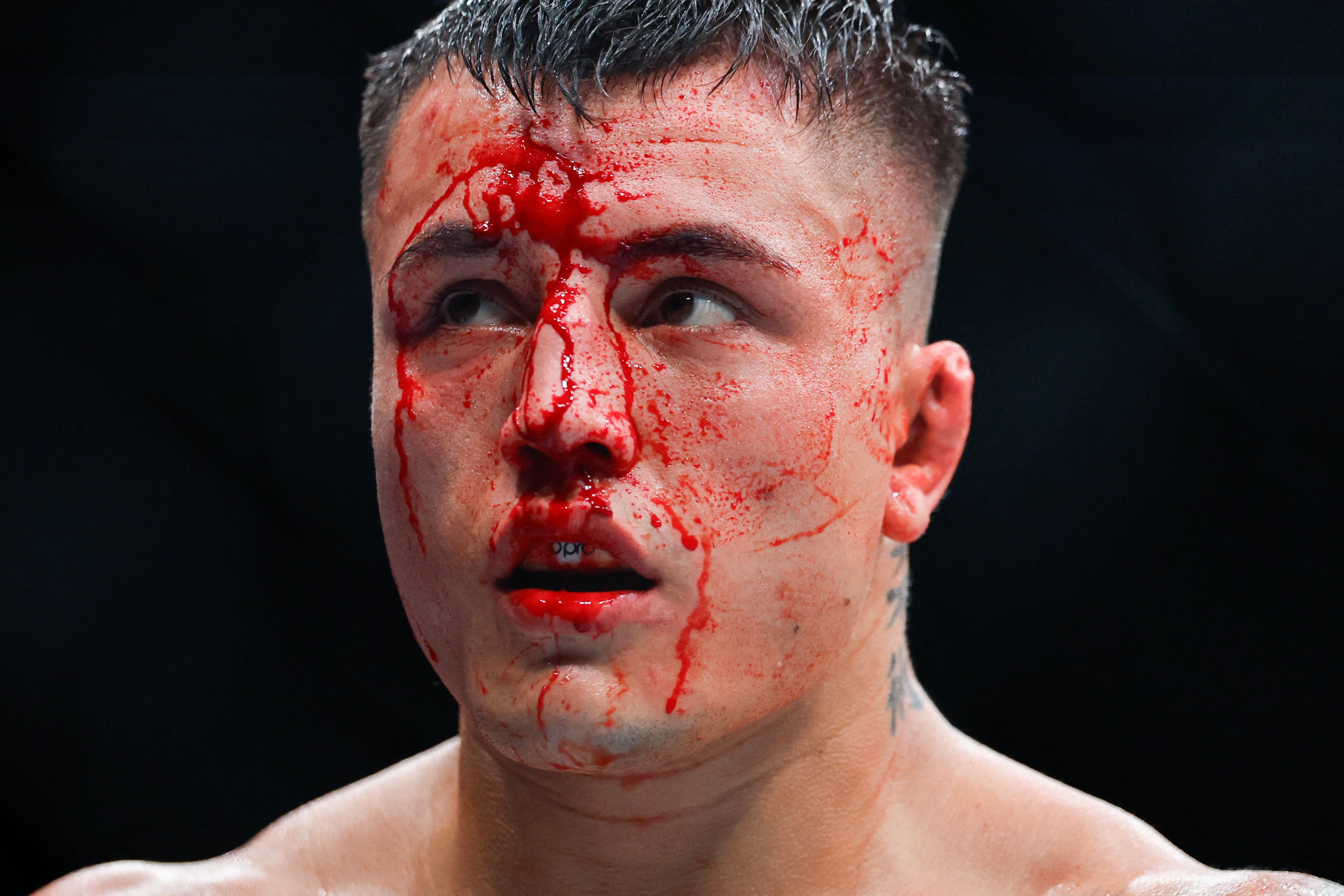 El argentino resultó gravemente herido durante el combate (Carmen Mandato /Getty Images via AFP)