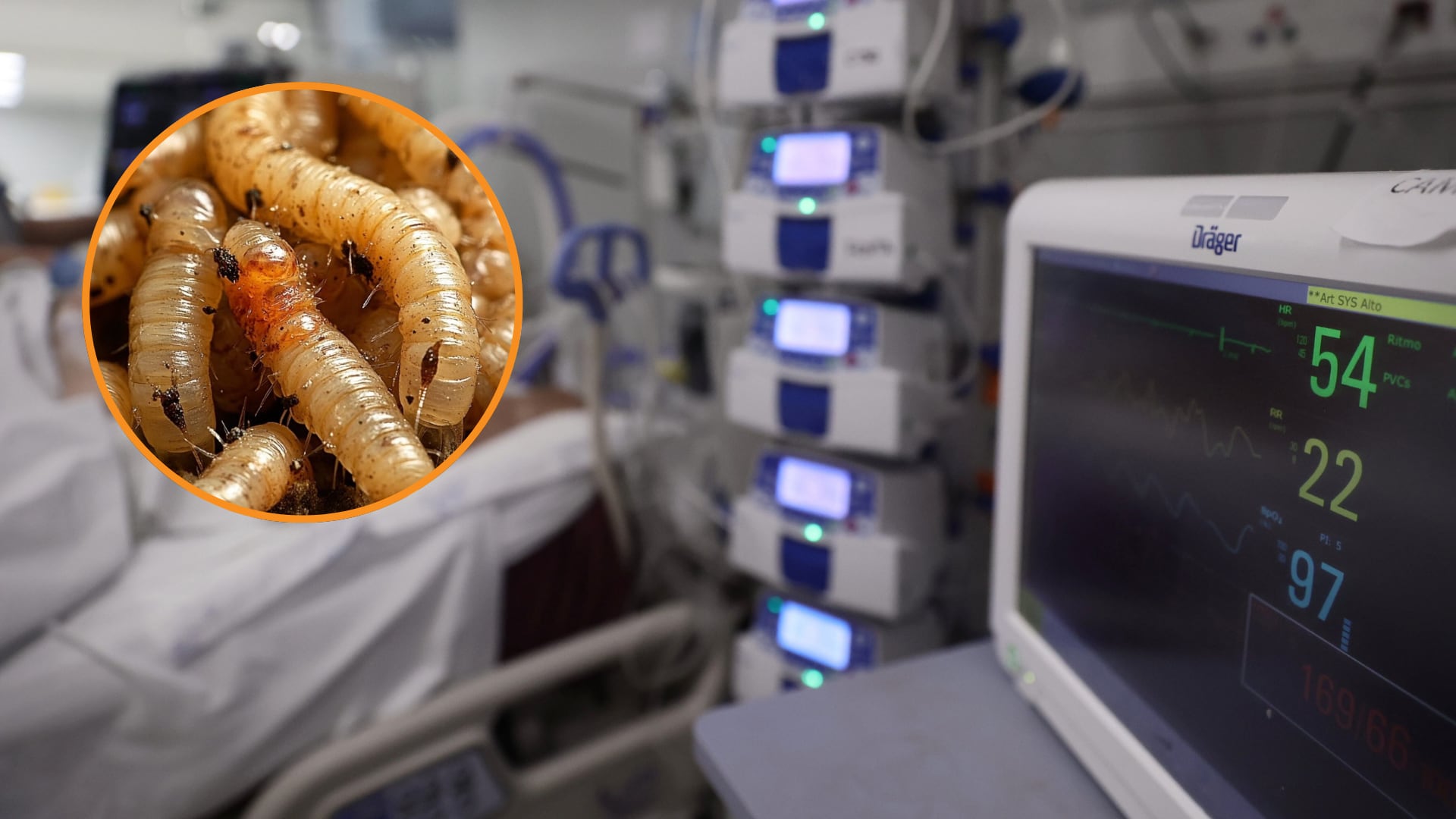 Un adulto mayor falleció en Oaxaca, entre sus diagnósticos se encontraba miasis asociada a gusano barrenador. (Europa Press/Infobae México)