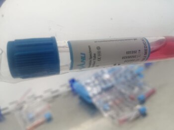 Más de 30 mil pruebas