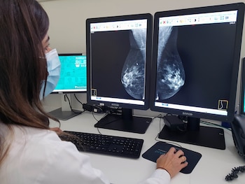 Los hallazgos se presentaron en el congreso anual de la Sociedad Europea de Cardiología en Múnich, el mayor evento mundial sobre enfermedades del corazón. (Europa Press)