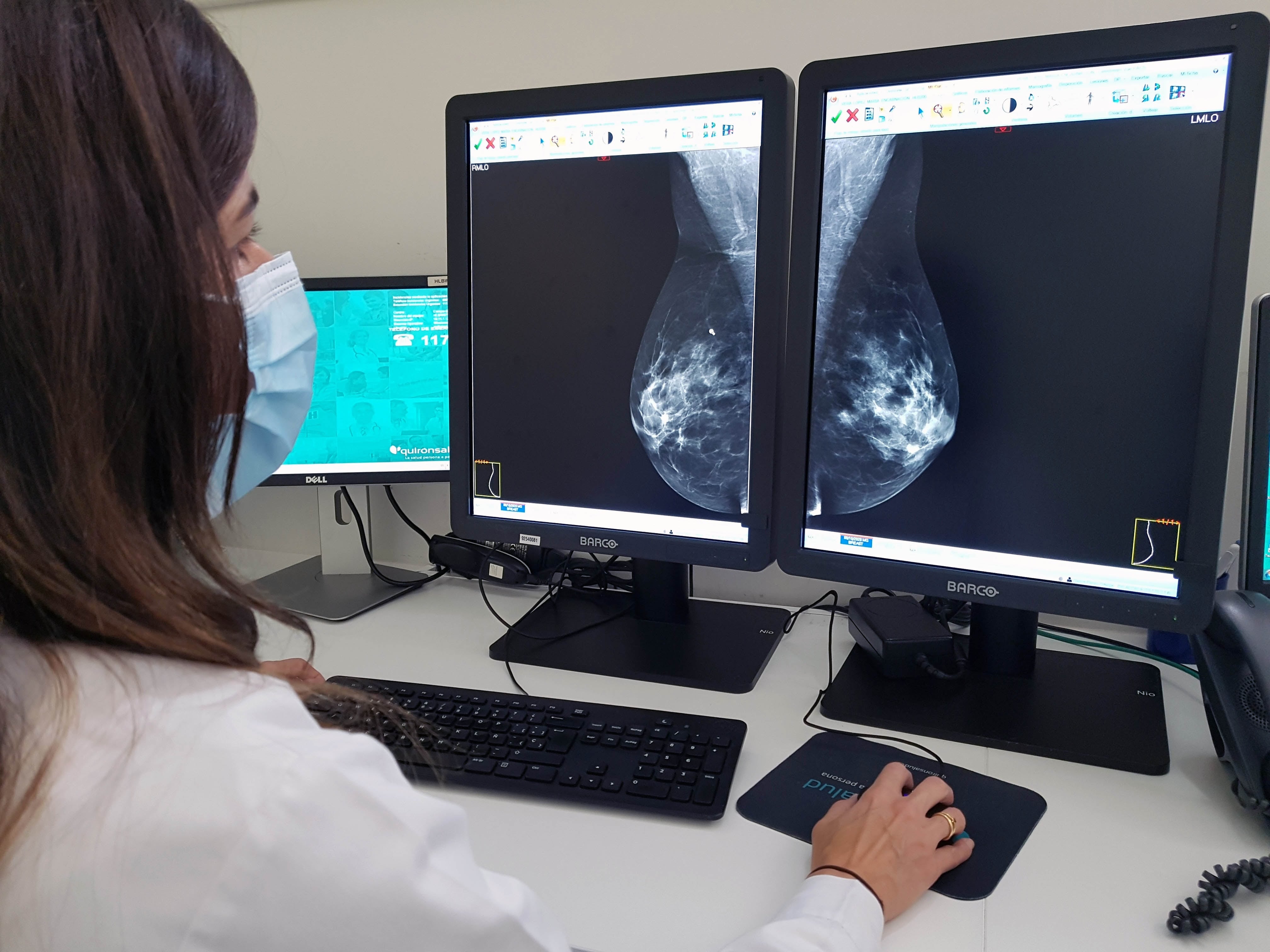 Los hallazgos se presentaron en el congreso anual de la Sociedad Europea de Cardiología en Múnich, el mayor evento mundial sobre enfermedades del corazón. (Europa Press)
