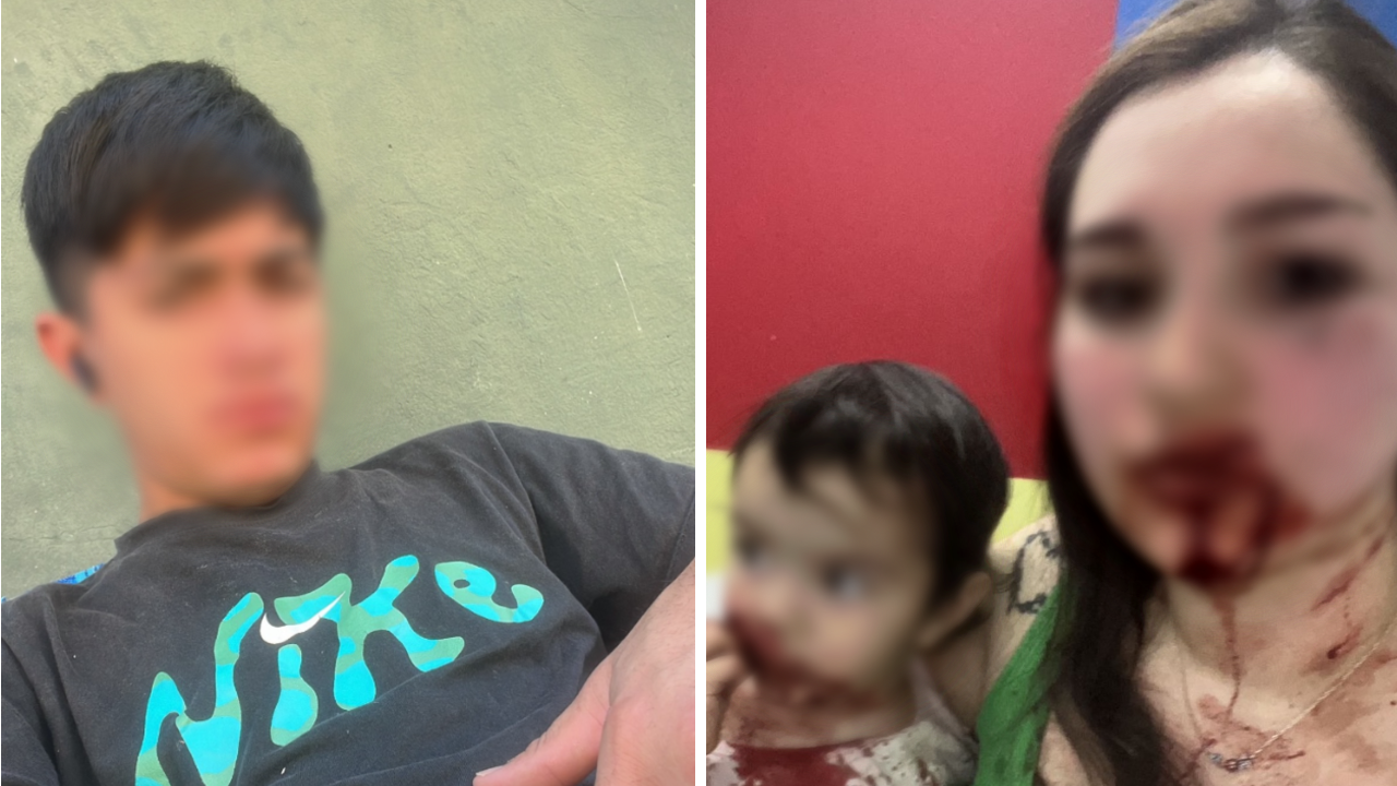 “Estamos vivas de milagro”: buscan a un prófugo por atacar con un cuchillo a su novia, a su bebé y a su suegra