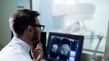 Descubren que el cáncer de cerebro más frecuente “se adapta y recluta células de su entorno” para resistir al tratamiento