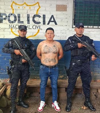 Los agentes detectaron que el hombre intentaba ocultar tatuajes alusivos a su pandilla con nuevos diseños para evadir la acción policial. (Foto cortesía Policía Nacional Civil)