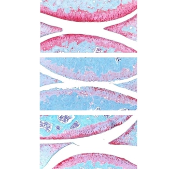 Articulación de la rodilla de