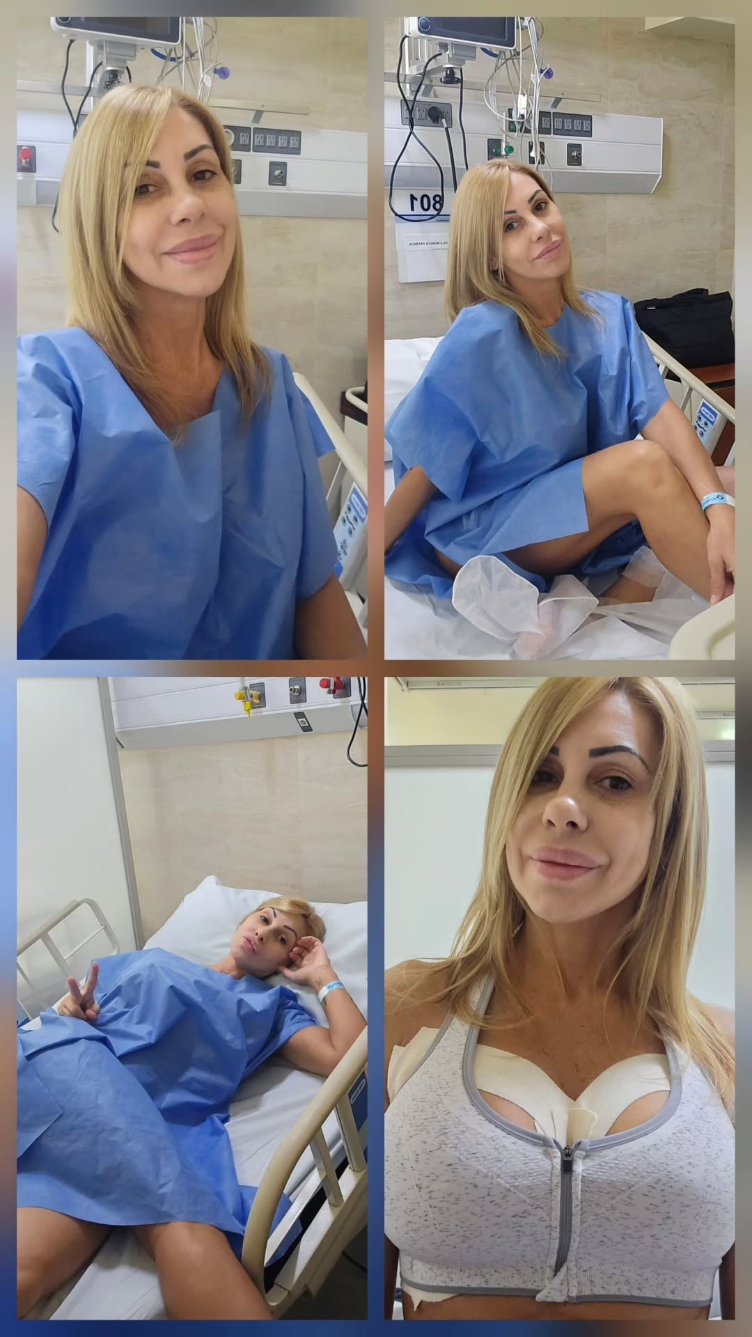 La publicación de Mónica Farro: antes y después de la cirugía mamaria