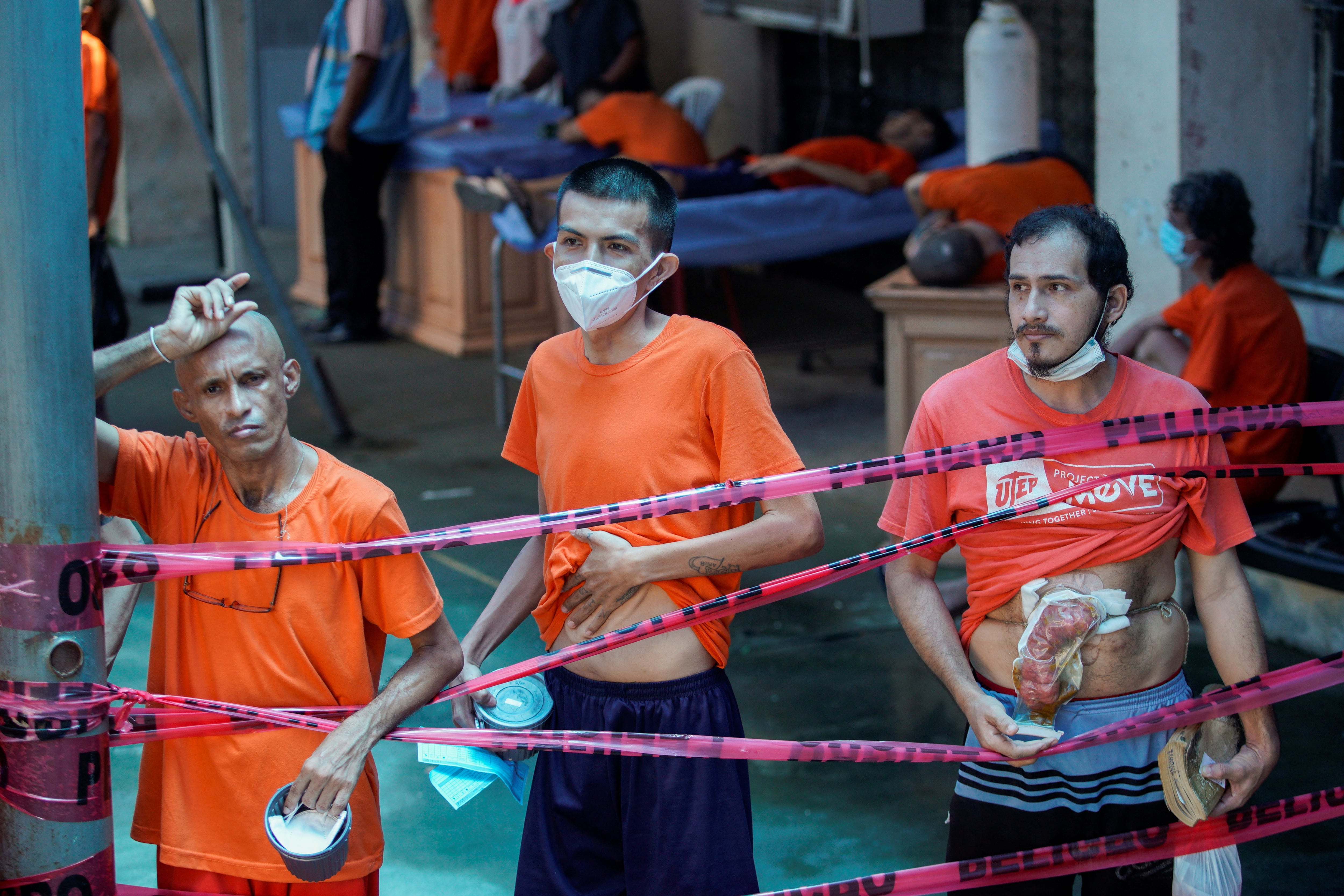 IMÁGENES SENSIBLES. Reclusos que requieren atención médica, incluyendo uno que sostiene parte de su tracto digestivo en una bolsa, muestran su estado físico en un pabellón de la Penitenciaría del Litoral, en medio de un brote de tuberculosis en Guayaquil, Ecuador (REUTERS/Santiago Arcos)