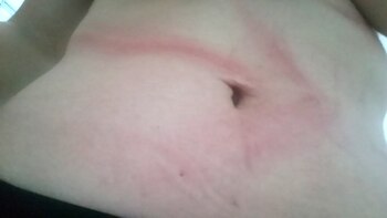 Las secuelas del horror en el cuerpo de Mariana