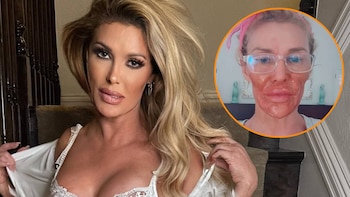 Brandi Glanville asegura tener una infección fúngica en la garganta contraída por vía sexual