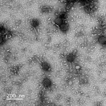 An image provided by Santiago Lopez/University of California, Berkeley shows micrographs of a virus that carries VIPR proteins, a gene-editing defense system in nature, found in viruses themselves. VIPR appears to be more than four billion years old, and it seems to be the evolutionary ancestor of CRISPR, researchers wrote in two papers published in Science on Thursday, Sept. 17, 2026. (Santiago Lopez/University of California, Berkeley via The New York Times) — NO SALES; FOR EDITORIAL USE ONLY WITH NYT STORY GENE EDITING BY CARL ZIMMER FOR SEPT. 17, 2026. ALL OTHER USE PROHIBITED. —