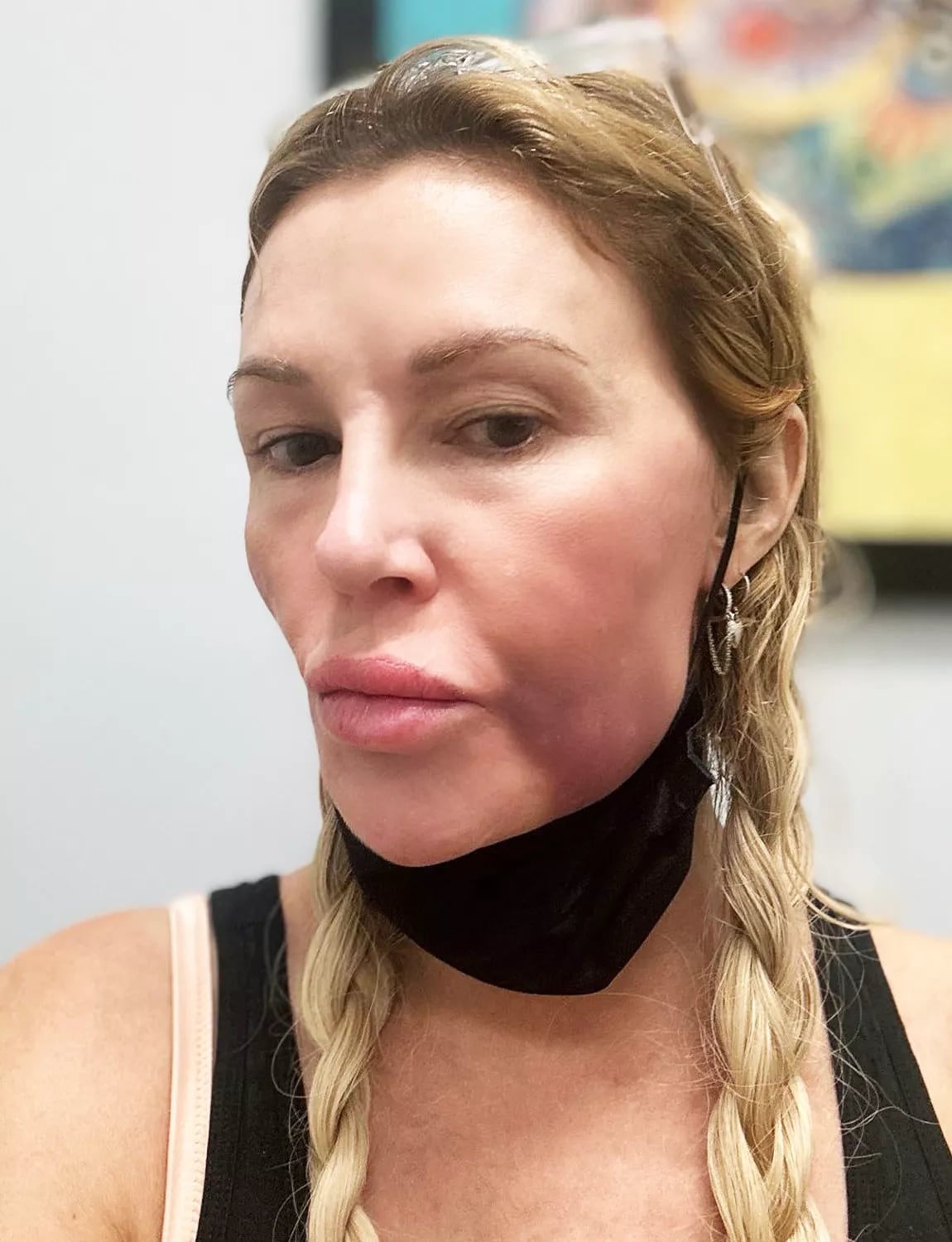 La exintegrante de Real Housewives of Beverly Hills afirmó que el problema facial le impide usar maquillaje durante más de unos minutos - (X/Brandi Glanville)