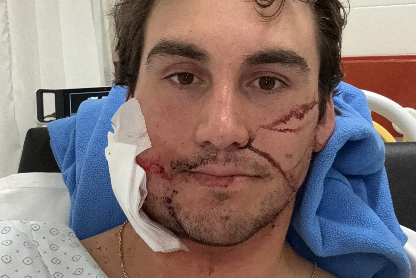 Un esquiador chileno anunció que no competirá en los JJOO de invierno