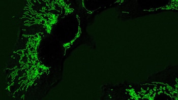 Una enzima de la levadura