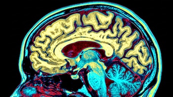 Cuál es el péptido de origen natural que mostró potencial para reducir la neuroinflamación y las proteínas tóxicas del Alzheimer
