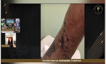 Tras el ataque, la hermana