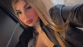 Tamara Báez mostró su nuevo retoque estético tras el anuncio de su embarazo: “Lo necesitaba”