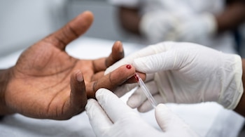 Unas manos con guantes blancos recogen con un tubo delgado una gota de sangre de la yema del dedo de otra persona.