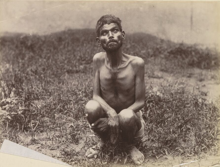 El caso de Dina Sanichar, el 'niño lobo' de la India, revela el impacto del aislamiento extremo en el desarrollo humano (WIkimedia Commons)