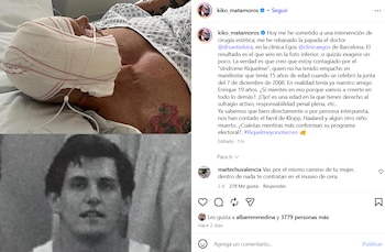 Las sobrecogedoras imágenes de Kiko Matamoros tras una nueva operación estética (Instagram)