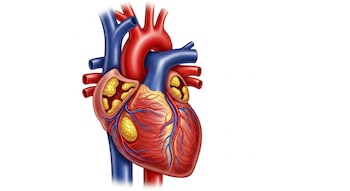 Ilustración de un corazón humano con arterias, venas y depósitos amarillos que obstruyen los vasos sanguíneos sobre un fondo blanco.