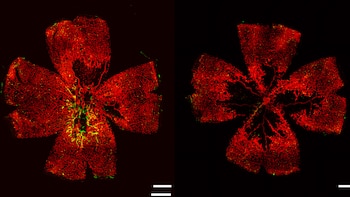 Dos micrografías de retina sobre fondo negro. Redes vasculares rojas. Pequeños puntos y ramificaciones verdes. Barras de escala blancas