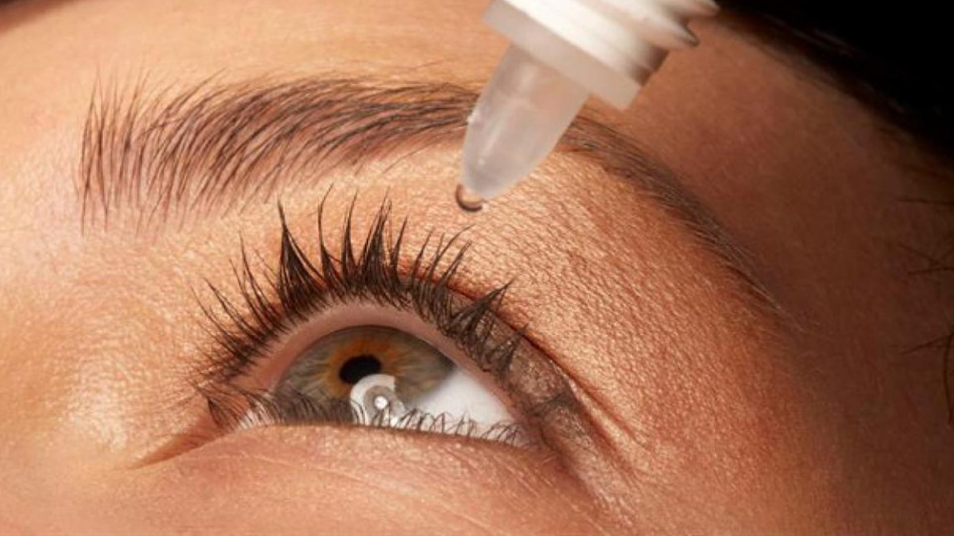 La autoridad peruana recomendó no usar las gotas señaladas tras un control de calidad que halló incumplimientos en el ensayo de partículas| Foto: Laser eyer center