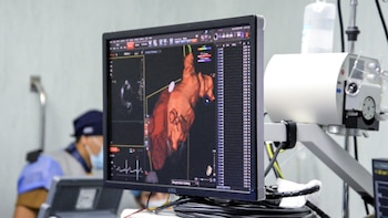 Essalud introduce tecnología de ablación