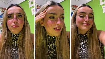 La chica contó su desafortunado