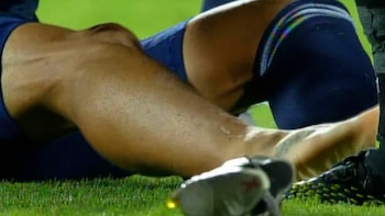 Una imagen de la pierna