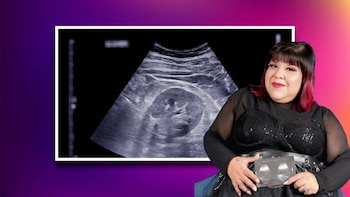 Hospitalizan a influencer Aimep3 tras