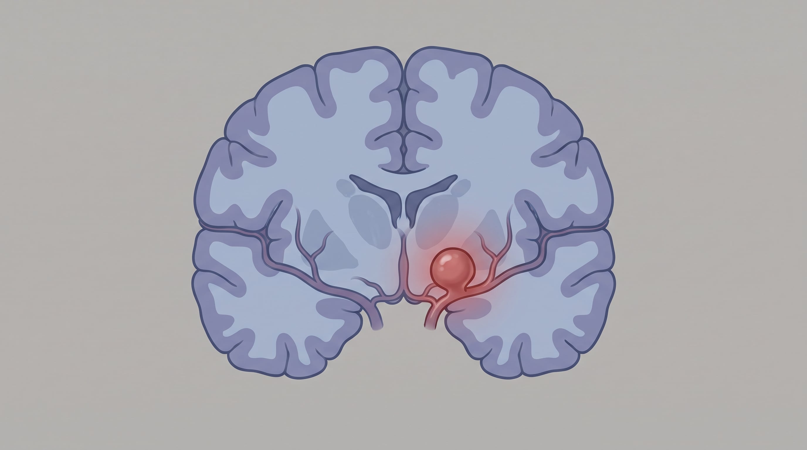 El aneurisma cerebral suele desarrollarse sin síntomas y puede permanecer oculto durante años (Imagen Ilustrativa Infobae)