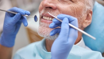 El cuidado dental puede ayudar a los pacientes con cirrosis a evitar el cáncer de hígado y la hospitalización