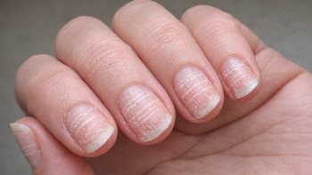 Si tienes las uñas estriadas, esta es la vitamina que debes tomar