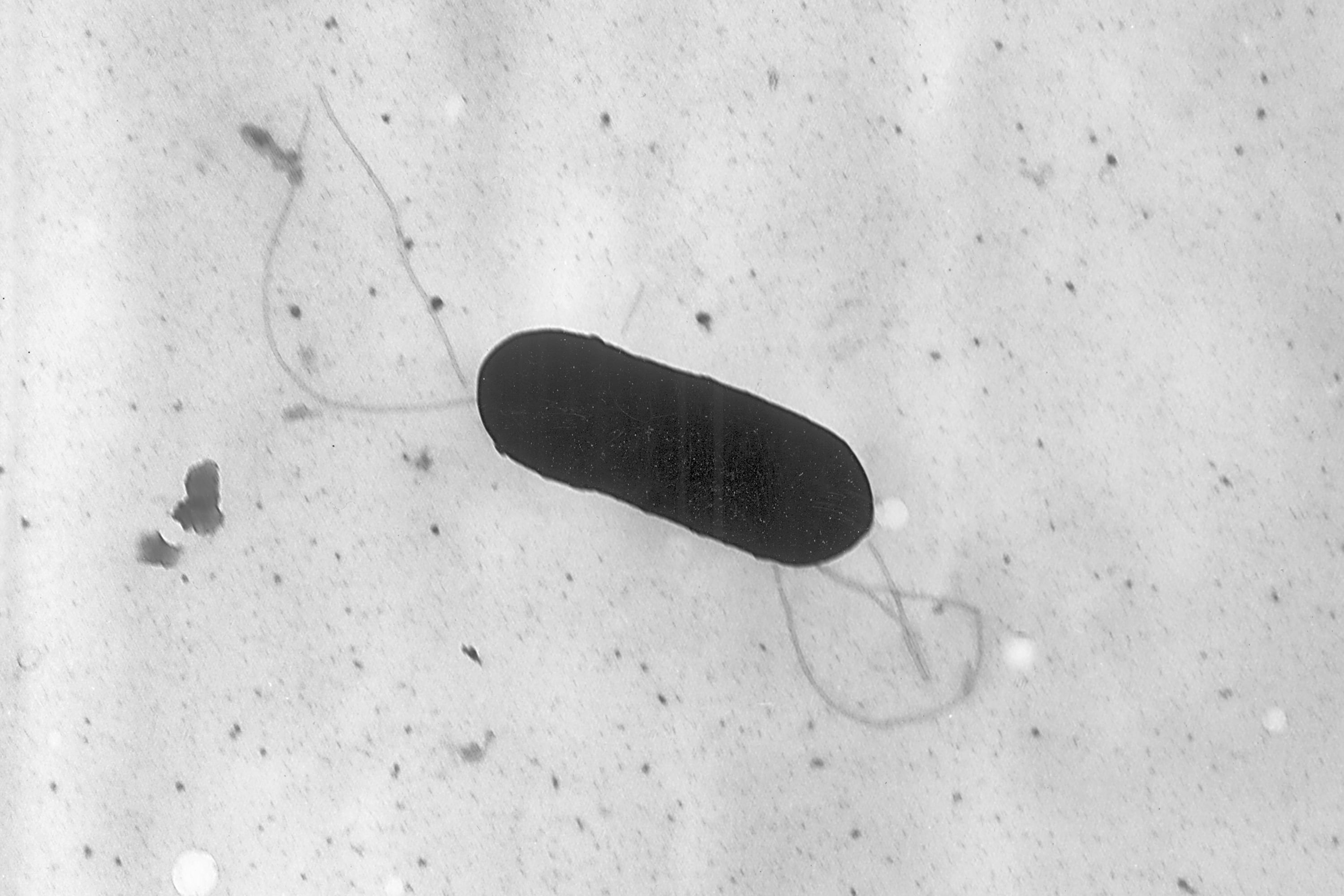 Los Centros para el Control y la Prevención de Enfermedades registran cerca de 1.250 contagios y 172 muertes por listeriosis al año en Estados Unidos (Elizabeth White/CDC vía AP, Archivo)