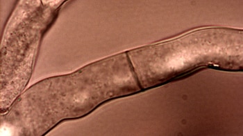 Este es un genero del