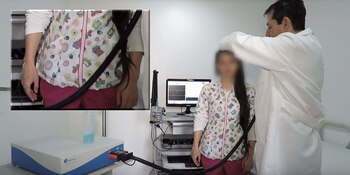 La parálisis cerebral, un grupo