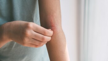 Del insomnio a la depresión: