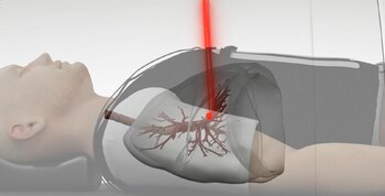 Synchrony permite compensar los movimientos