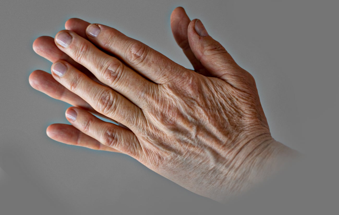 Las manos reflejan la edad tanto como la cara y también para ellas existen tratamientos