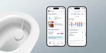 Dispositivo de Withings, U-Scan, analiza