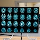 Un fármaco que reprograma el sistema inmunitario abre la puerta a un nuevo tratamiento contra el cáncer de cerebro más frecuente
