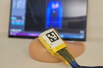 Un sensor de ultrasonido portátil podría permitir la detección temprana del cáncer de mama