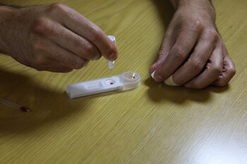 Aumentan diagnósticos de VIH gracias
