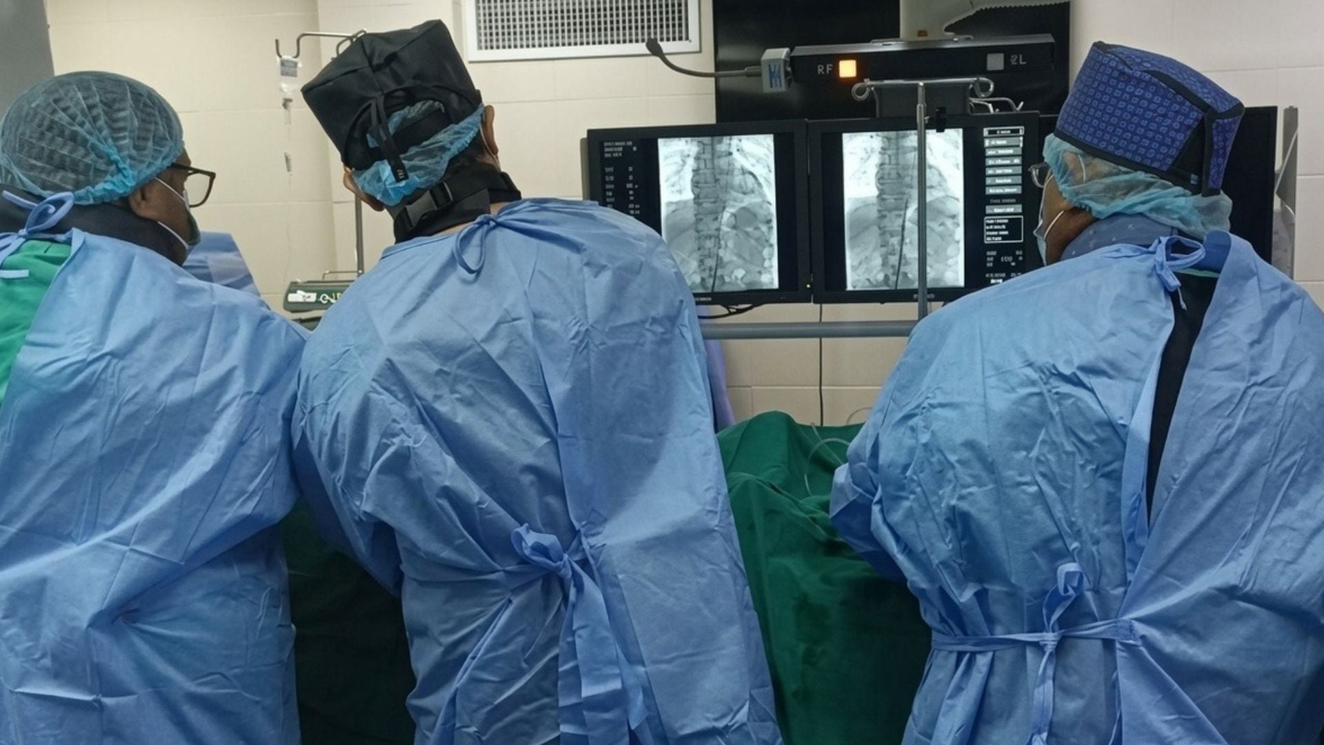 Paciente de 55 años deja atrás 37 años de dolor tras inédita cirugía cardiovascular en Chiclayo - Créditos: Essalud.